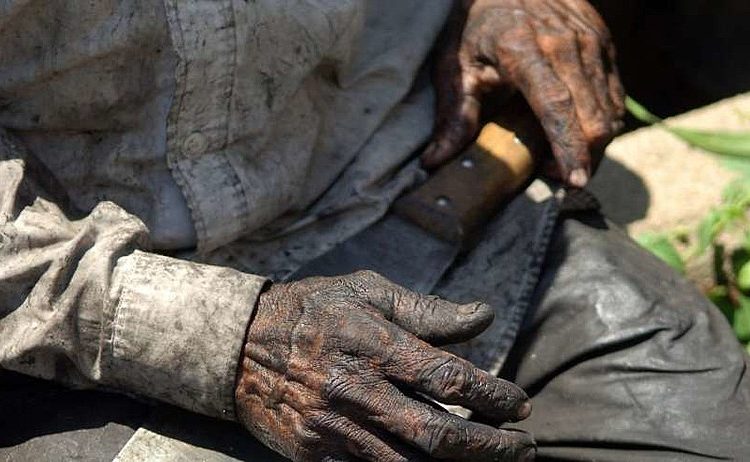 A Aspirina, um dos medicamentos mais vendidos na história, tem trabalho escravo em sua composição