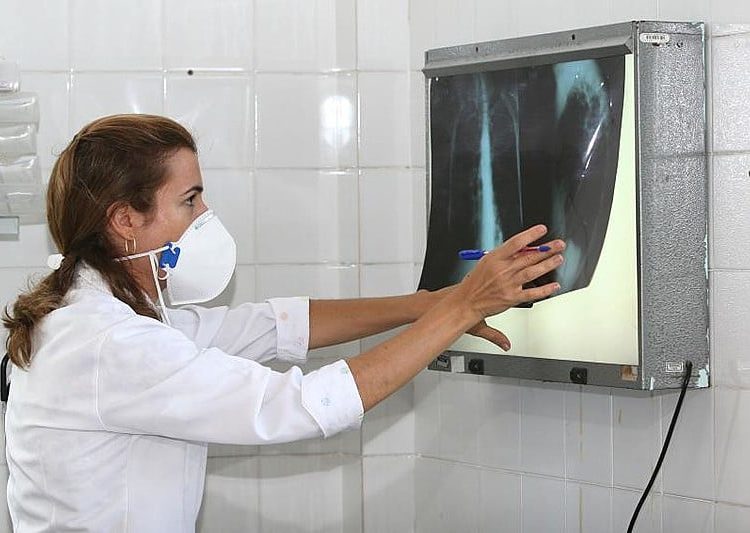 Estado do Rio de Janeiro possui a segunda maior incidência de casos de tuberculose no país