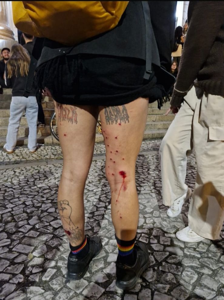 Estudante ferida pela PM durante protesto na UFPR disse que levou tiros e apanhou deitada no chão